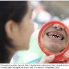 'I look like a monster': Mother sues unlicensed dentist after bungled treatment left her so ugly she frightens her baby