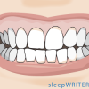 Do You Grind Your Teeth While Sleeping?