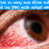 What Causes Red Eyes After Swimming or Bath In a Public
